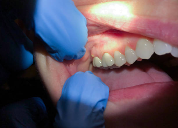 Best Weekend Emergency Dentist in Salmon Brook, CT