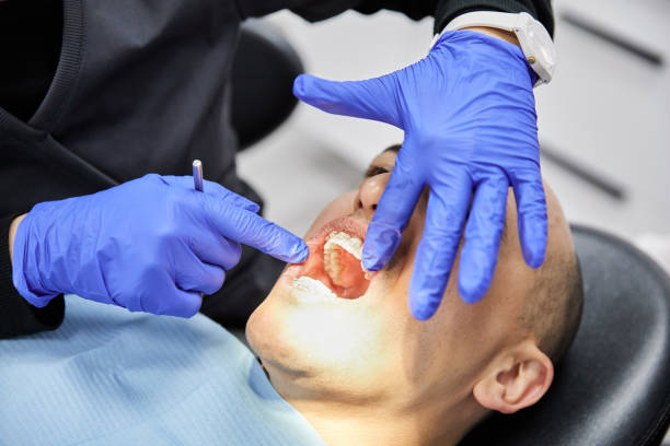 Best Emergency Denture Repair in Salmon Brook, CT